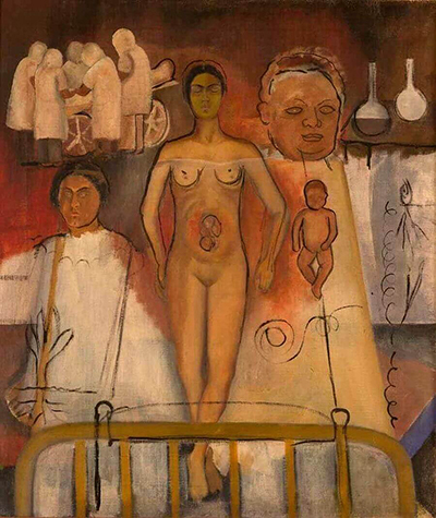 Frida and the Caesarean Operation or The Hospital Frida Kahlo